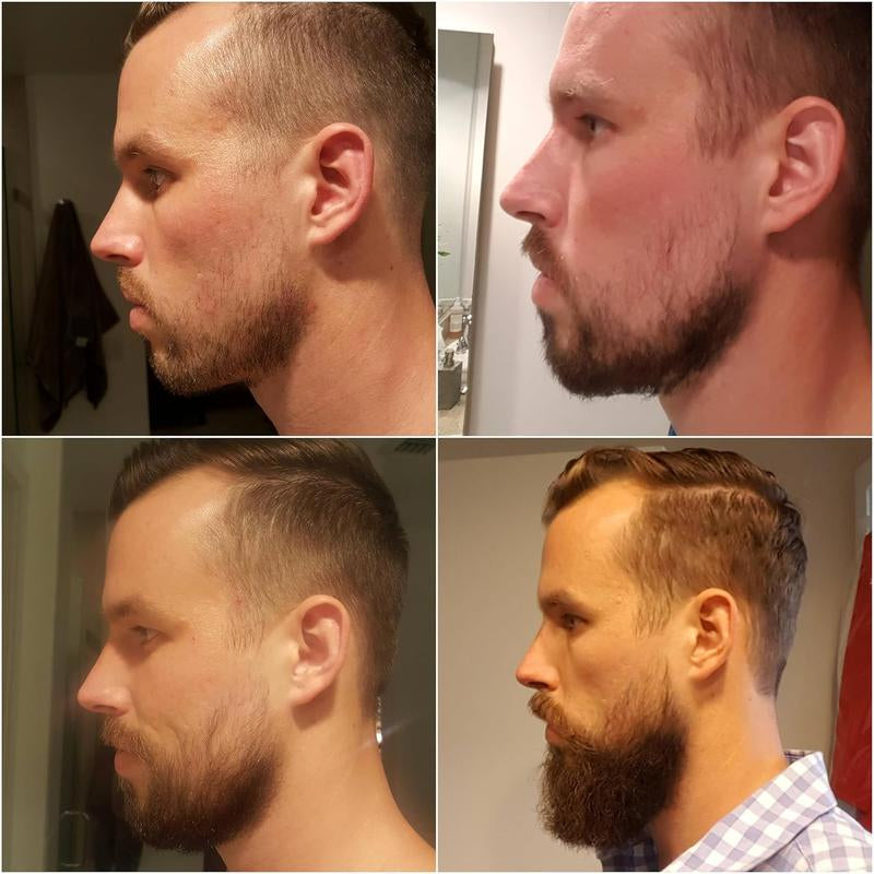 Beard Growth Kit - TILLARE Beard Grooming Kit with Beard Growth Oil, Balm, Comb, Massager, Christmas & Birthday Gifts for Men Husband Dad Boyfriend